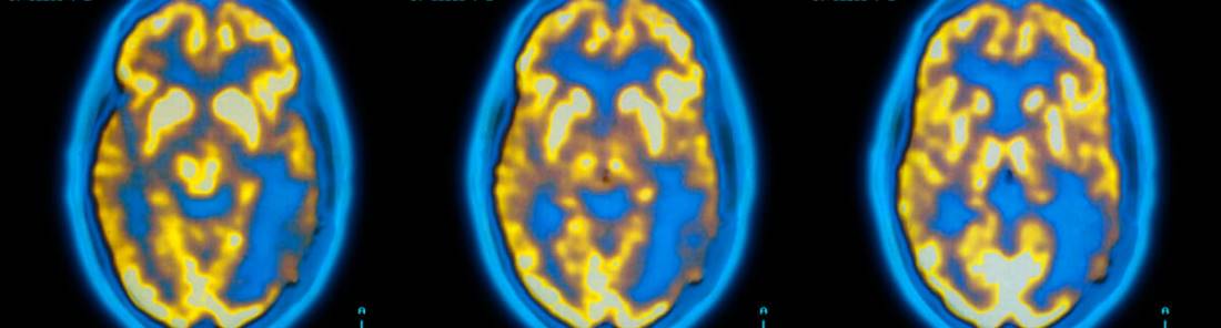 Nuclear Medicine