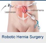 Robotic Hernia Surgery